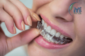  عيادات تقويم اسنان بجدة رخيصة