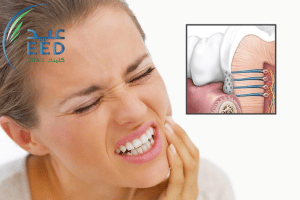 اسباب واعراض وعلاج تسوس الاسنان