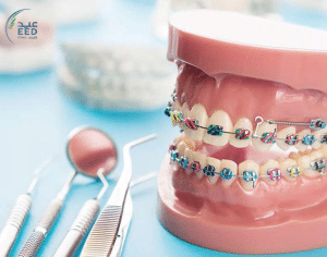 عيادات تقويم اسنان بجدة رخيصة 2023