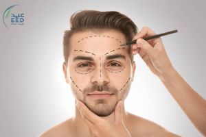 عمليات التجميل الأكثر شيوعا بين الرجال 